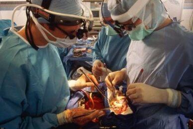 Microsurgery muscle transplantation